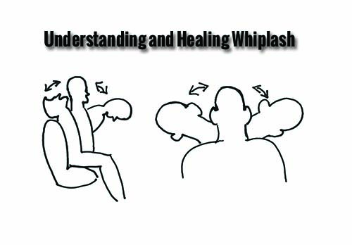 whiplash drawing RS